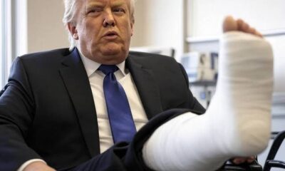 Breaking News: President Donald Trump Falls, Breaks Ankle While Leaving the White House—Rushed to Hospital. “THE PRESIDENT IS SAID TO BE IN CRITICAL PAINS”….See More